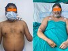 करिश्मा मेडिकल साइंस का : डॉक्टरों ने किया कमाल, दिल्ली के पेंटर को मिले नए 'हाथ'