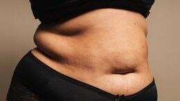 Women's Health: Avoid These Foods During Menopause To Manage Excess Belly Fat