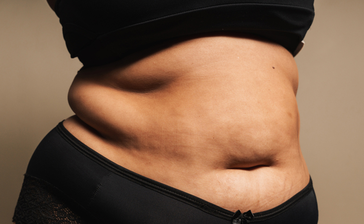 Slower metabolism and lifestyle factors can further exacerbate weight gain during menopause
