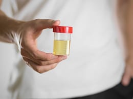 पेशाब में बहुत ज्यादा प्रोटीन आ रहा है कैसे पता करें? इन 4 तरीकों से ले सकते हैं आप पूरी जानकारी