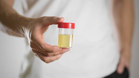 सिर्फ पानी की कमी ही नहीं इन 5 कारणों से भी हो जाता है यूरिन का रंग पीला |  Not Only Dehydration But These 5 Reasons Also Make The Urine Yellow
