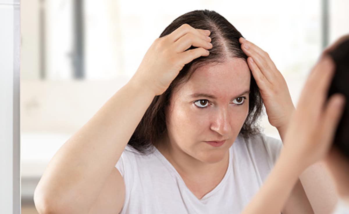 78gq5e18_hair-mask-to-stop-hair-fall_625x300_17_March_24 बहुत ज़्यादा हो रहा है Hair Fall गंजे होने की आ गई है नौबत, ऐसे लगाना शुरू करें प्याज़ का रस बालों में, 1 महीने में बाल की काया जाएगी पलट