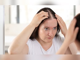 मानसून में बालों पर क्या लगाना चाहिए ताकि बाल झड़े नहीं? ये रामबाण घरेलू नुस्खा है कमाल, बाल होंगे लंबे, घने और मजबूत मानसून में बालों पर क्या लगाना चाहिए ताकि बाल झड़े नहीं? ये रामबाण घरेलू नुस्खा है कमाल, बाल होंगे लंबे, घने और मजबूत