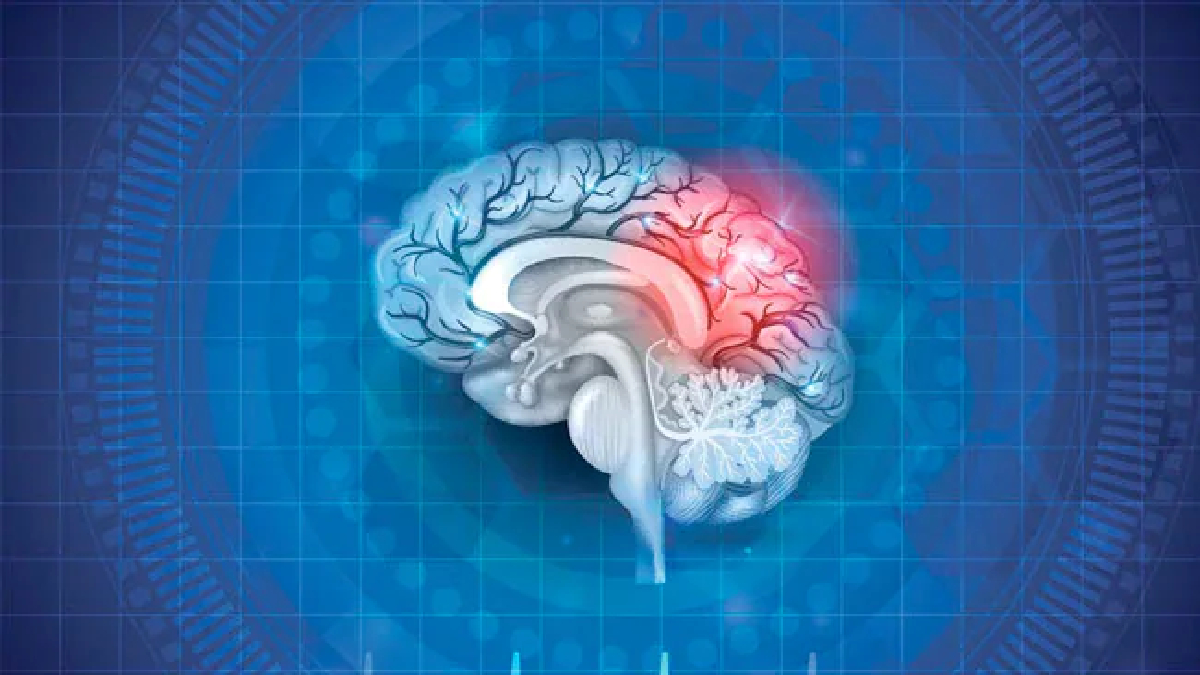 People With 2 Copies Of Risk Gene Have Genetic Form Of Alzheimer's: Study