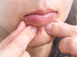 चेहरे पर आयदिन हो जाती हैं फुंसियां तो इस तरह लगाकर देख लीजिए तुलसी, Pimples नहीं आएंगे फिर नजर  चेहरे पर आयदिन हो जाती हैं फुंसियां तो इस तरह लगाकर देख लीजिए तुलसी, Pimples नहीं आएंगे फिर नजर