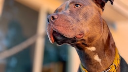 7-Year-Old Girl Injured In Sudden Attack By Pitbull In Chennai: Police