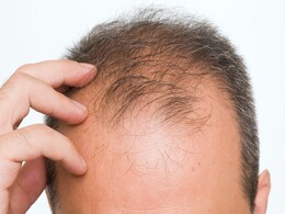 बाल झड़ रहे हैं गंजापन लगा है झलकने तो खाएं ये 5 चीजें, बाल की ग्रोथ हो जाएगी तेज बाल झड़ रहे हैं गंजापन लगा है झलकने तो खाएं ये 5 चीजें, बाल की ग्रोथ हो जाएगी तेज