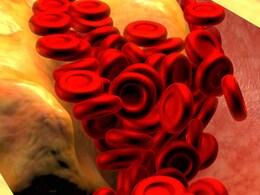 कोलेस्ट्रॉल को पिघला कर शरीर से निकाल फेंकेंगे ये ग्रीन कलर के फ्रूट्स, जानिए इनके फायदे