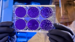 Govt Amends Drugs Rules To Bring Stem Cell, Gene Therapies Under Central Licensing