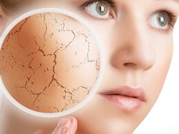 डिहाइड्रेशन से स्किन पर नजर आ सकते हैं ये लक्षण, जानें इससे बचने के उपाय