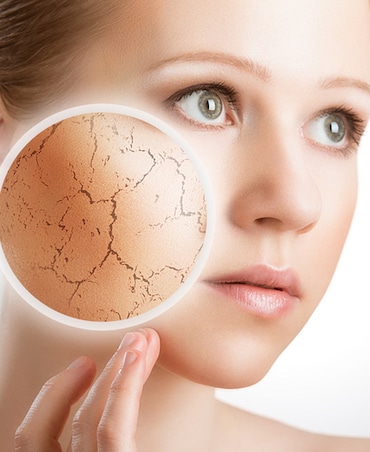 Remedies For Ashy Skin In Winter