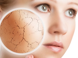 As You Age, Dry Skin Gets Worse In Winter; Desi Hacks That Help