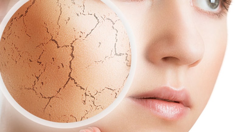 As You Age, Dry Skin Gets Worse In Winter; Desi Hacks That Help