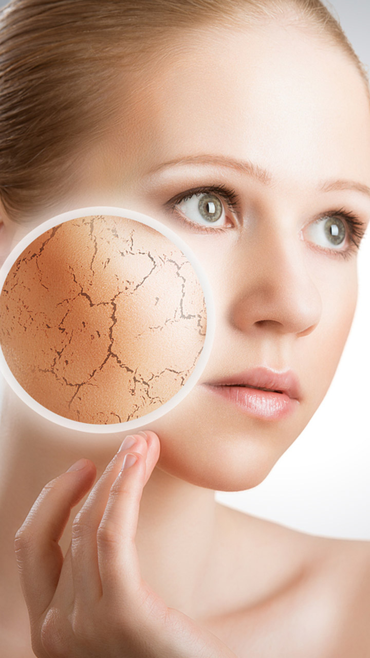 As You Age, Dry Skin Gets Worse In Winter; Desi Hacks That Help