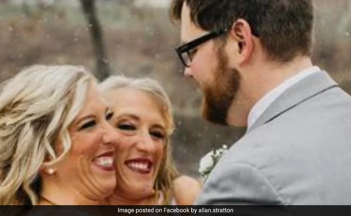 Conjoined Twin Abby Hensel Marries US Army Veteran