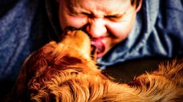 Dogs Licking Owners' Face Is Not Just Unhealthy, But Can Even Be Fatal