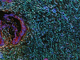 कैंसर से बचना है, तो बदलें अपनी ये 5 आदतें, डॉक्टर से जानें कैसे कम कर सकते हैं कैंसर का खतरा कैंसर से बचना है, तो बदलें अपनी ये 5 आदतें, डॉक्टर से जानें कैसे कम कर सकते हैं कैंसर का खतरा