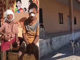 मध्य प्रदेश-छत्तीसगढ़ में नहीं थम रहे डॉग्स बाइट के मामले, यहां मासूम बने शिकार...  मध्य प्रदेश-छत्तीसगढ़ में नहीं थम रहे डॉग्स बाइट के मामले, यहां मासूम बने शिकार...