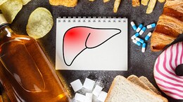 5 Foods You Need To Stock Up On To Help Reverse Fatty Liver