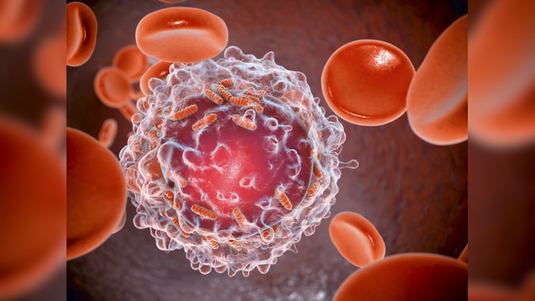 Blood cancer awareness month: ब्लड कैंसर अवेयरनेस मंथ मनाया जाता है सितंबर में, जानें क्या होते हैं इसके लक्षण?