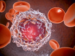 Blood cancer awareness month: ब्लड कैंसर अवेयरनेस मंथ मनाया जाता है सितंबर में, जानें क्या होते हैं इसके लक्षण? Blood cancer awareness month: ब्लड कैंसर अवेयरनेस मंथ मनाया जाता है सितंबर में, जानें क्या होते हैं इसके लक्षण?