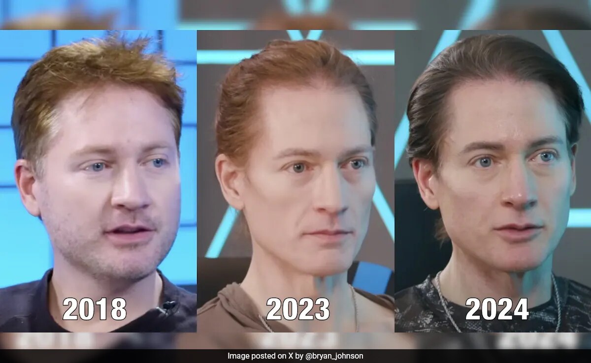 Millionaire Bryan Johnson Shares Pics Of His Age Reversing Millionaire Bryan Johnson Shares Pics Of His Age Reversing