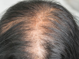 अदरक की चाय इन 4 तरीकों से बाल को पहुंचाती है फायदा अदरक की चाय इन 4 तरीकों से बाल को पहुंचाती है फायदा