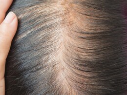 महिलाएं जरूर पढ़ें : क्यों झड़ रहे हैं आपके बाल और बालों का झड़ना कैसे रोक सकती हैं आप महिलाएं जरूर पढ़ें : क्यों झड़ रहे हैं आपके बाल और बालों का झड़ना कैसे रोक सकती हैं आप