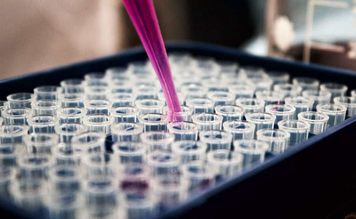 Indian Scientists Identify Clues In Body's Cells To Develop Therapies For Alzheimer's And Cancer