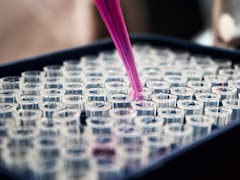 Indian Scientists Identify Clues In Body's Cells To Develop Therapies For Alzheimer's And Cancer