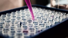 Indian Scientists Identify Clues In Body's Cells To Develop Therapies For Alzheimer's And Cancer