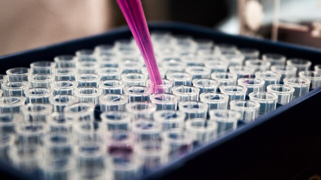 Indian Scientists Identify Clues In Body's Cells To Develop Therapies For Alzheimer's And Cancer