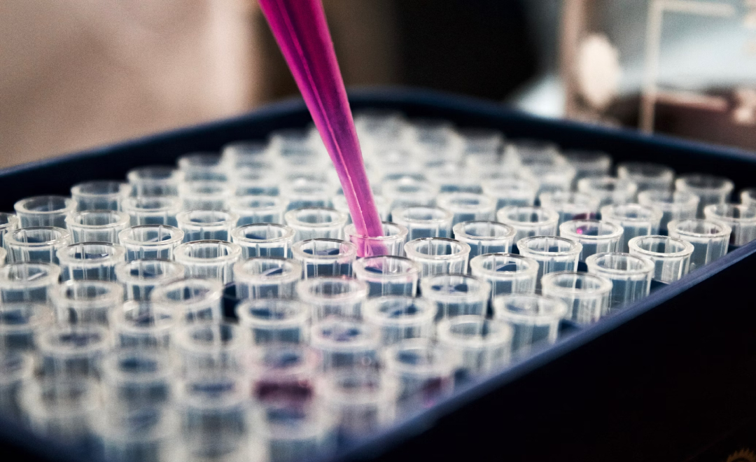 Indian Scientists Identify Clues In Body's Cells To Develop Therapies For Alzheimer's And Cancer