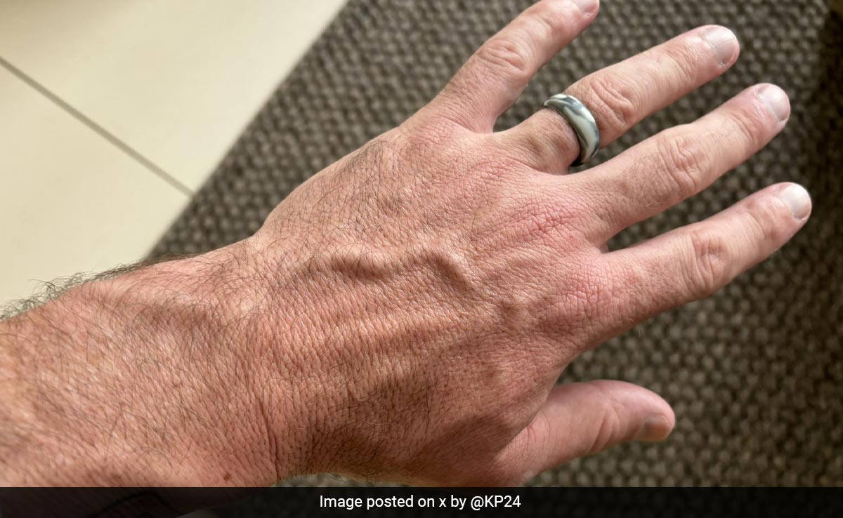 England Cricket Great Removes Watch, Wears Plastic Ring Before Going To London, After Calling It "Disgrace"