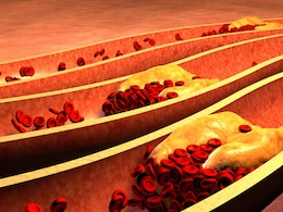बढ़ गया है कॉलेस्ट्रोल तो रसोई के इन मसालों का सेवन कर दीजिए शुरू, High Cholesterol होने लगेगा कम  बढ़ गया है कॉलेस्ट्रोल तो रसोई के इन मसालों का सेवन कर दीजिए शुरू, High Cholesterol होने लगेगा कम