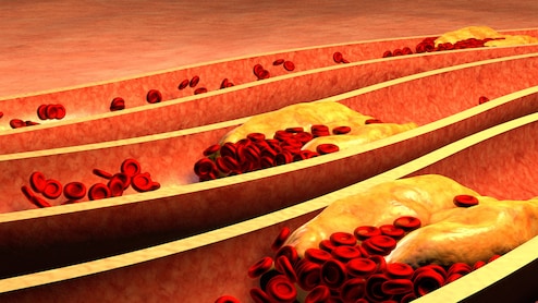 हल्&zwj;दी, लहसुन समेत ये 3 सुपरफूड्स हैं कमाल, खुल जाएंगी बंद नसें, गंदा खून भी होगा साफ, जानें इस्&zwj;तेमाल का सही तरीका