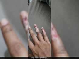 Delhi Doctor Is ''Boycotting'' Uber After Getting Hurt In Accident, Company Reacts Delhi Doctor Is ''Boycotting'' Uber After Getting Hurt In Accident, Company Reacts