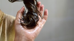 Haircare Tips: Try These Hair Masks To Prevent Dandruff This Winter