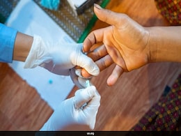 Sexually Transmitted Diseases Killing 2.5 Million People Every Year Globally: UN Sexually Transmitted Diseases Killing 2.5 Million People Every Year Globally: UN