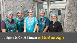 बिलासपुर: महिला के पेट से निकला 10 किलो का ट्यूमर, 9 महीने की लग रही थी गर्भवती, सिम्स के डॉक्टर्स ने दिया जीवनदान