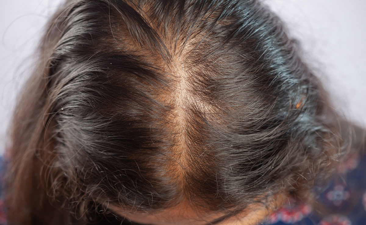 बालों को बढ़ाने के लिए तेल लगाने के सही तरीके से लेकर असरदार हेयर मास्क बनाना भी है जरूरी, जानिए कमाल के ट्रिक्स 