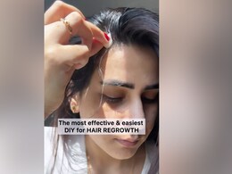 Hair Care: क्या वापस आ सकते हैं गिरे हुए बाल? डॉक्टर ने बताया नए बाल उगाने का तरीका Hair Care: क्या वापस आ सकते हैं गिरे हुए बाल? डॉक्टर ने बताया नए बाल उगाने का तरीका