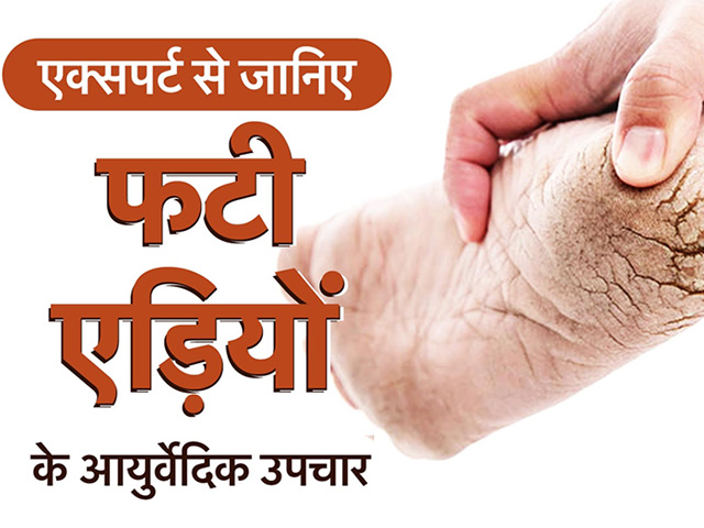 Cracked Heels: गर्मियों में फटने लगी हैं एड़ियां, इन घरेलू नुस्खों को एक बार जरूर करें ट्राई