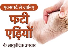 Cracked Heels: गर्मियों में फटने लगी हैं एड़ियां, इन घरेलू नुस्खों को एक बार जरूर करें ट्राई Cracked Heels: गर्मियों में फटने लगी हैं एड़ियां, इन घरेलू नुस्खों को एक बार जरूर करें ट्राई