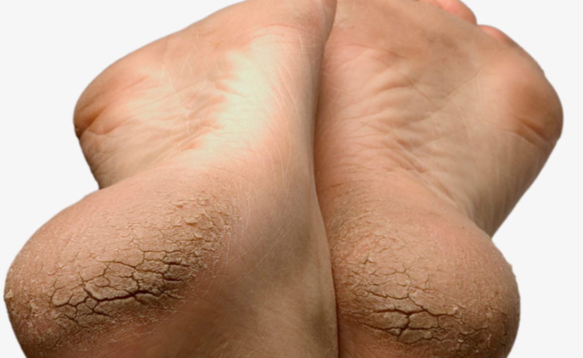 Latest and Breaking News on NDTV Latest and Breaking News on NDTV