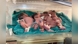 महिला ने एक साथ 4 बच्चों को दिया जन्म, डॉक्टर भी रह गए हैरान; कह दी ये बड़ी बात