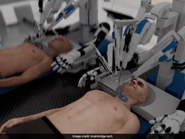 रोबोटिक सर्जन करेंगे दुनिया की पहली हेड ट्रांसप्लांट सर्जरी? दूसरे के शरीर में लग जाएगा आपका सिर - देखें Video रोबोटिक सर्जन करेंगे दुनिया की पहली हेड ट्रांसप्लांट सर्जरी? दूसरे के शरीर में लग जाएगा आपका सिर - देखें Video