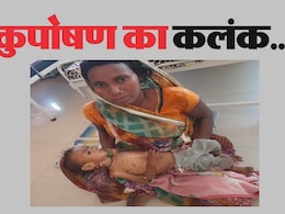 MP News: कुपोषण का दंश... महिला एवं बाल विकास विभाग के आंकड़े से मचा हडकंप, इतने बच्चे मिले अति कुपोषित MP News: कुपोषण का दंश... महिला एवं बाल विकास विभाग के आंकड़े से मचा हडकंप, इतने बच्चे मिले अति कुपोषित