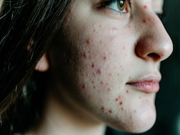 चेहरे का ग्लो हो गया है गायब औऱ निकल आएं हैं पस वाले दाने तो करिए 'स्किन फास्टिंग', यहां जानिए इसका तरीका चेहरे का ग्लो हो गया है गायब औऱ निकल आएं हैं पस वाले दाने तो करिए 'स्किन फास्टिंग', यहां जानिए इसका तरीका