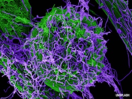 Chinese Scientists Create Mutant Ebola Virus In Lab That Causes Horrific Symptoms Chinese Scientists Create Mutant Ebola Virus In Lab That Causes Horrific Symptoms